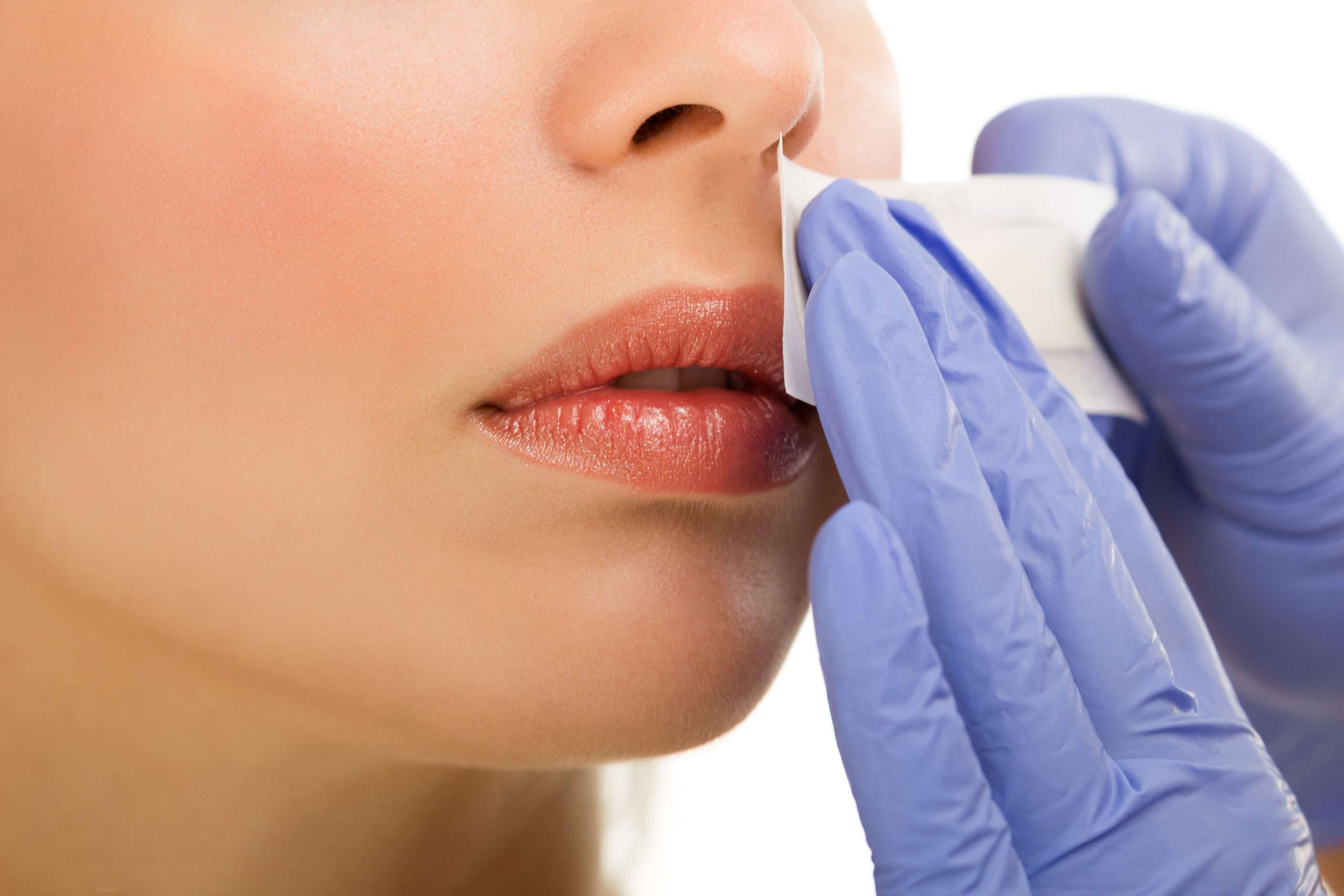 Waxen lip